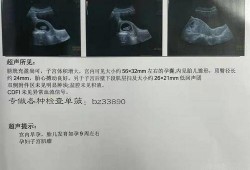 怀胎在线观看,揭秘孕期生活点滴